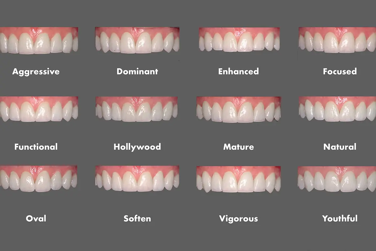 انواع ابتسامات هوليود الأكثر شيوعا