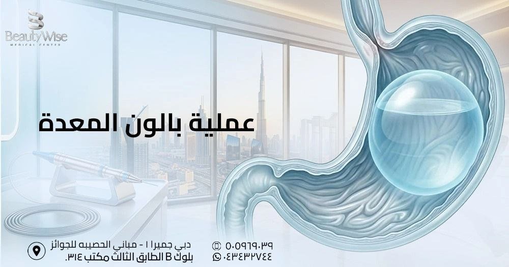 عملية بالون المعدة