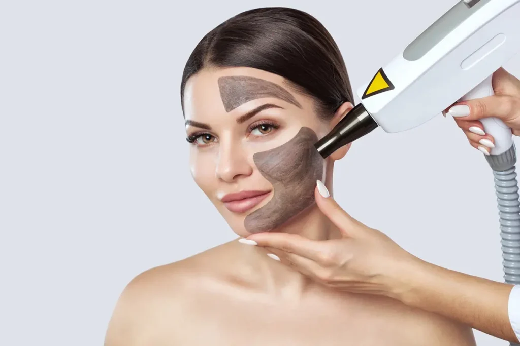 ليزر كربوني للوجه