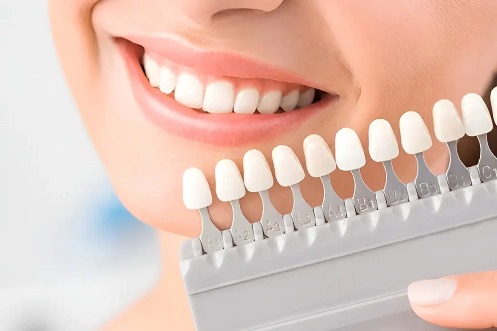 درجات الوان ابتسامة هوليود