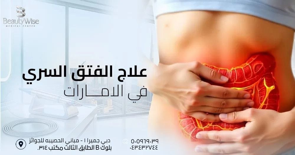 علاج الفتق السري في الامارات
