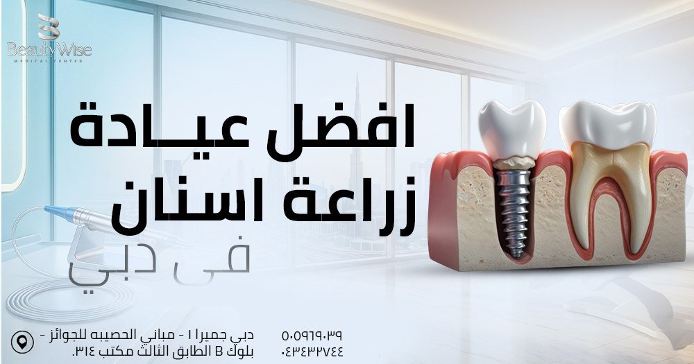 افضل عيادة زراعة اسنان في دبي