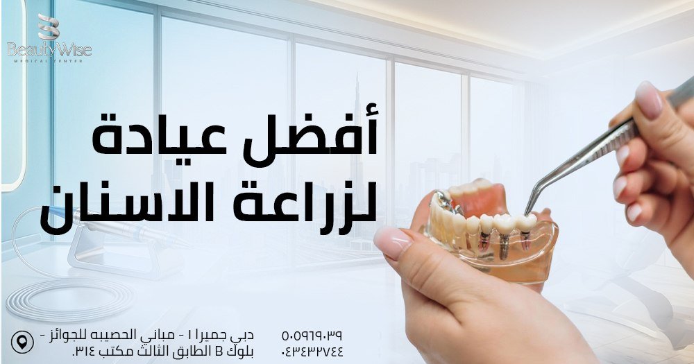 افضل عيادة لزراعة الاسنان