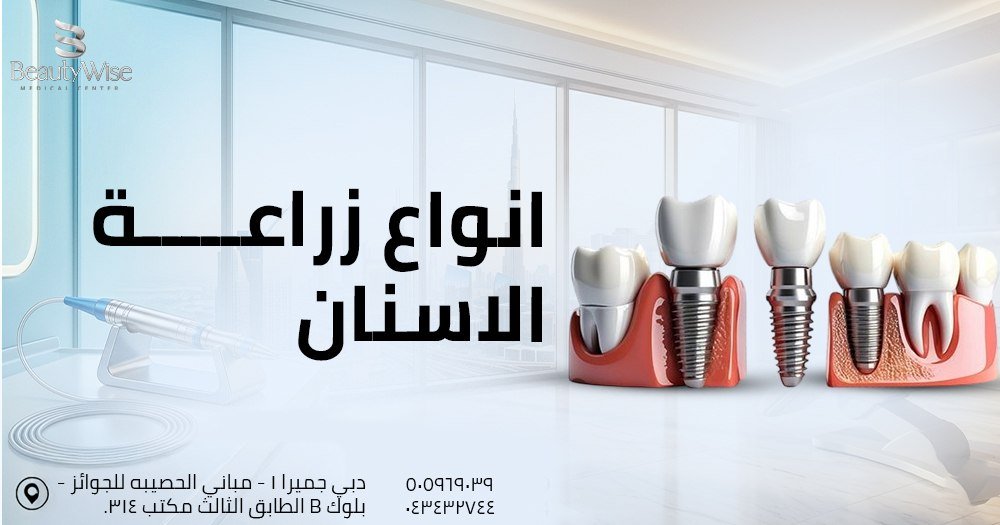 انواع زراعة الاسنان