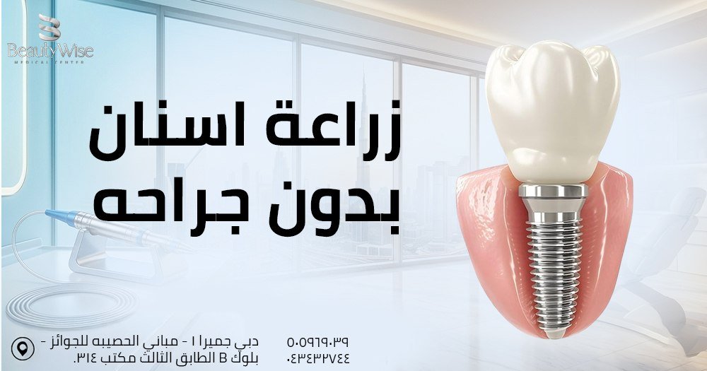 زراعة اسنان بدون جراحه