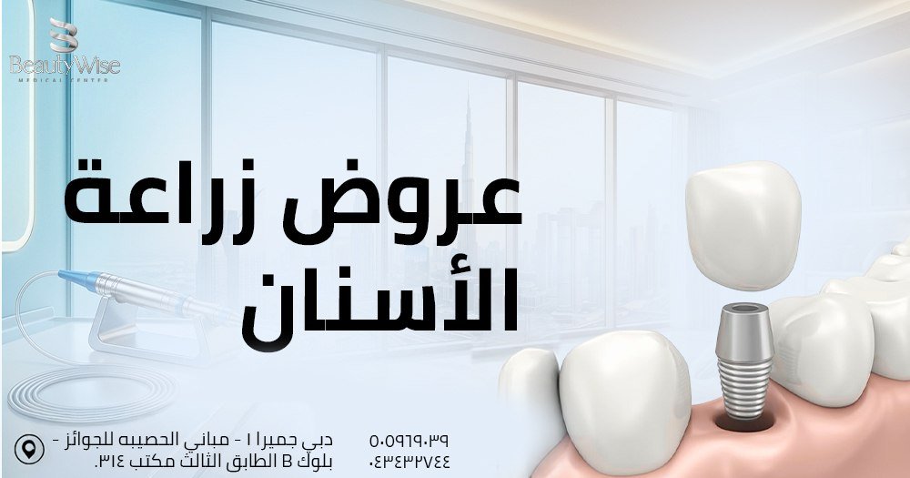 عروض زراعة الأسنان 