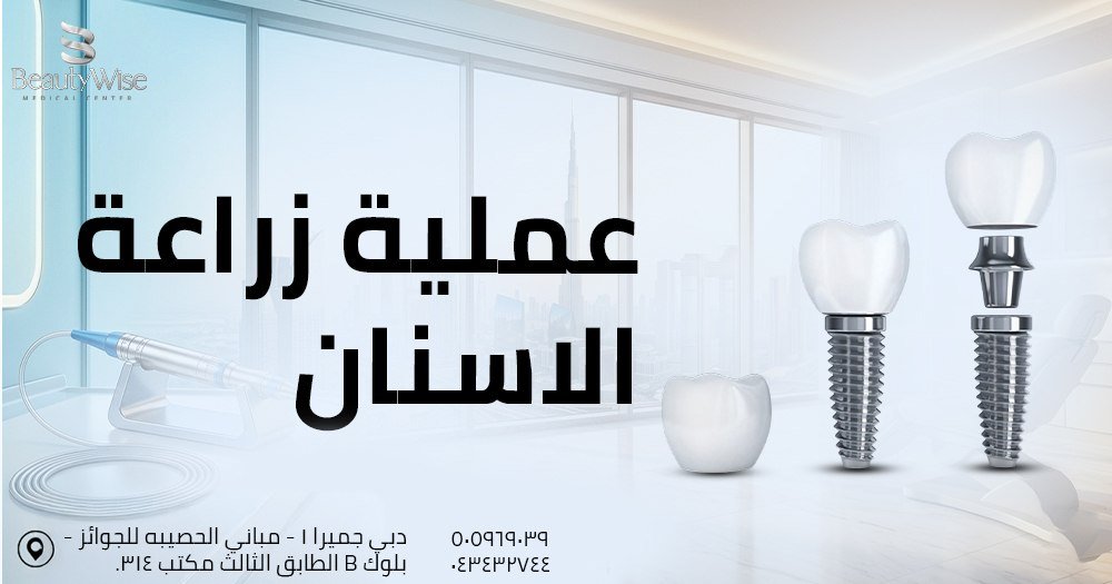 عملية زراعة الاسنان