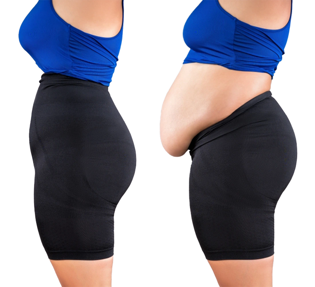Liposuction 360 & Total Body Contouring