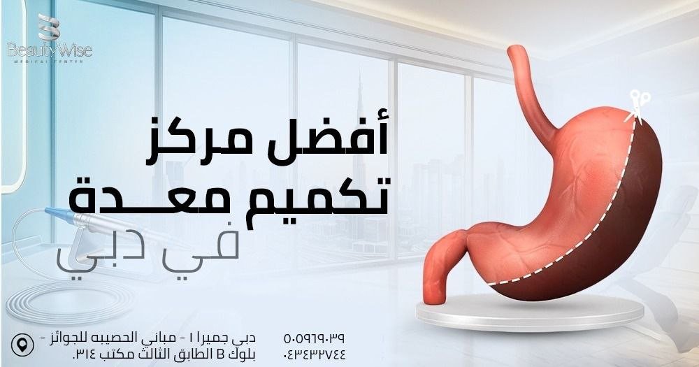 أفضل مركز تكميم معدة في دبي