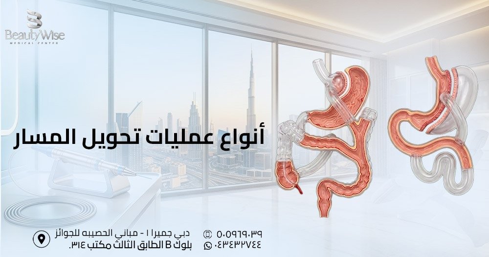 أنواع عمليات تحويل المسار