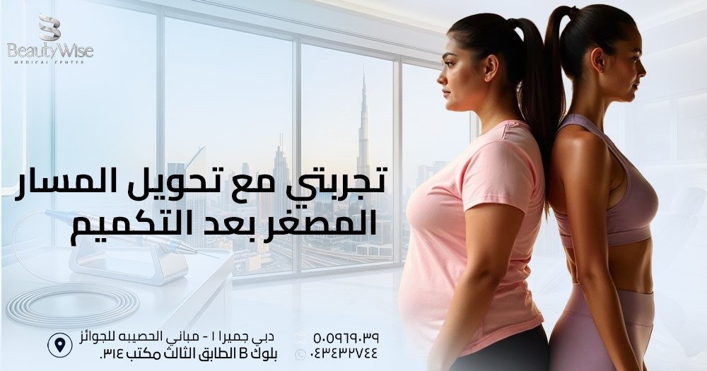 تجربتي مع تحويل المسار المصغر بعد التكميم