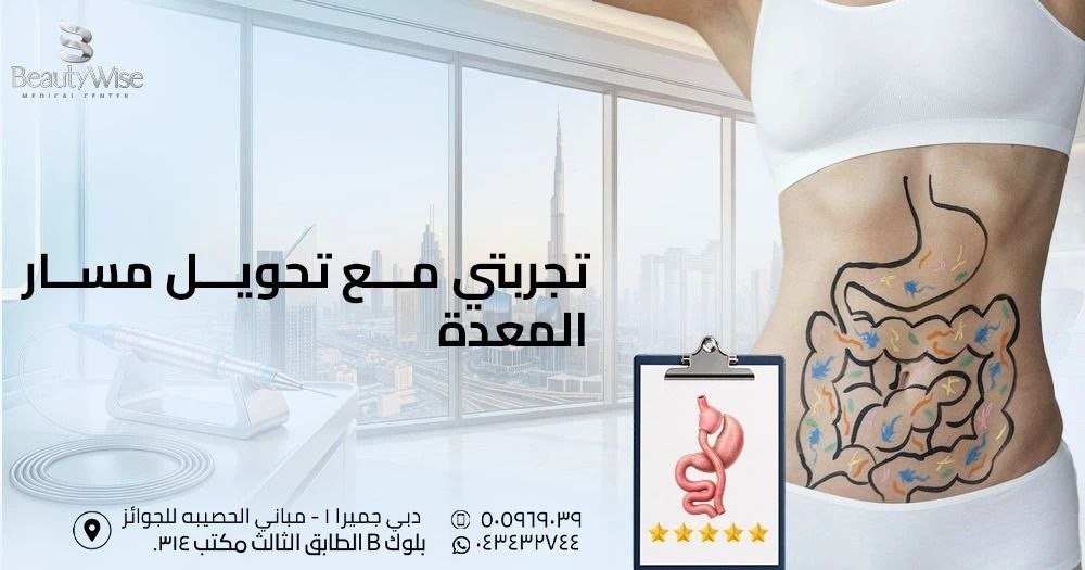 تجربتي مع تحويل مسار المعدة