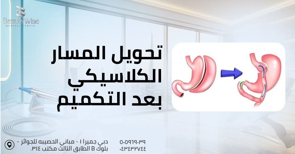 تحويل المسار الكلاسيكي بعد التكميم