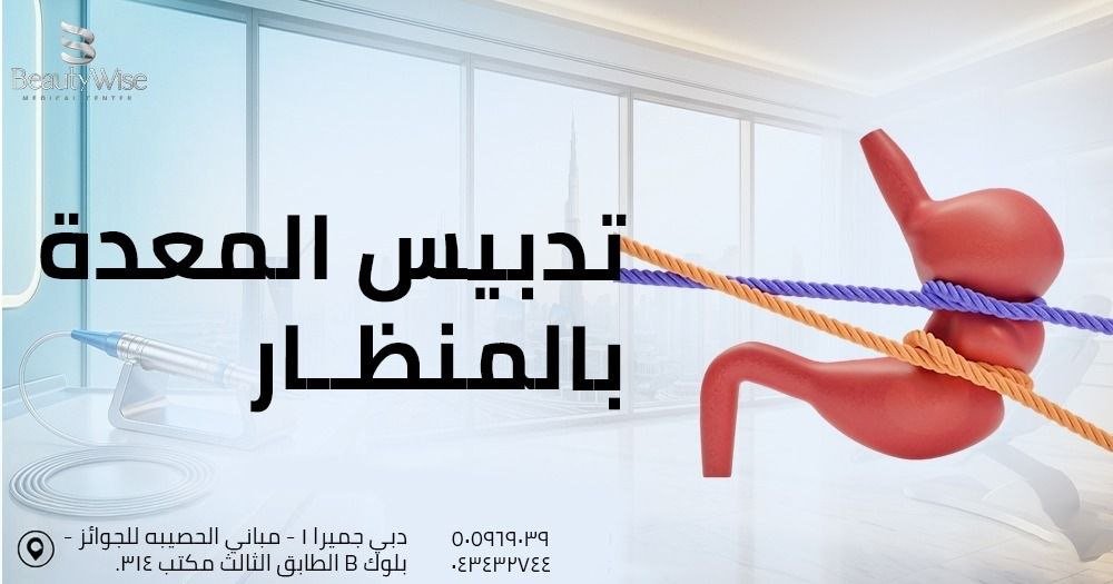 تدبيس المعدة بالمنظار