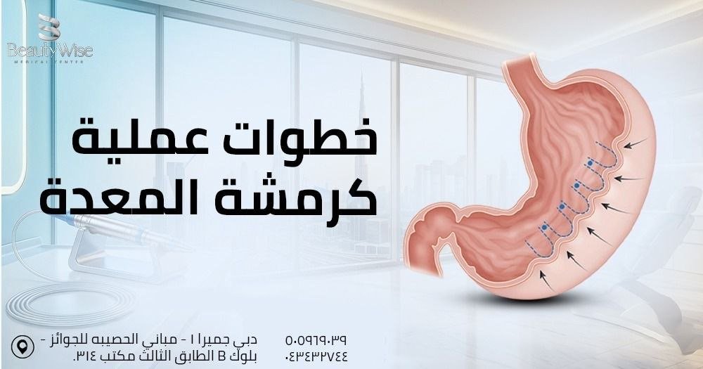 خطوات عملية كرمشة المعدة