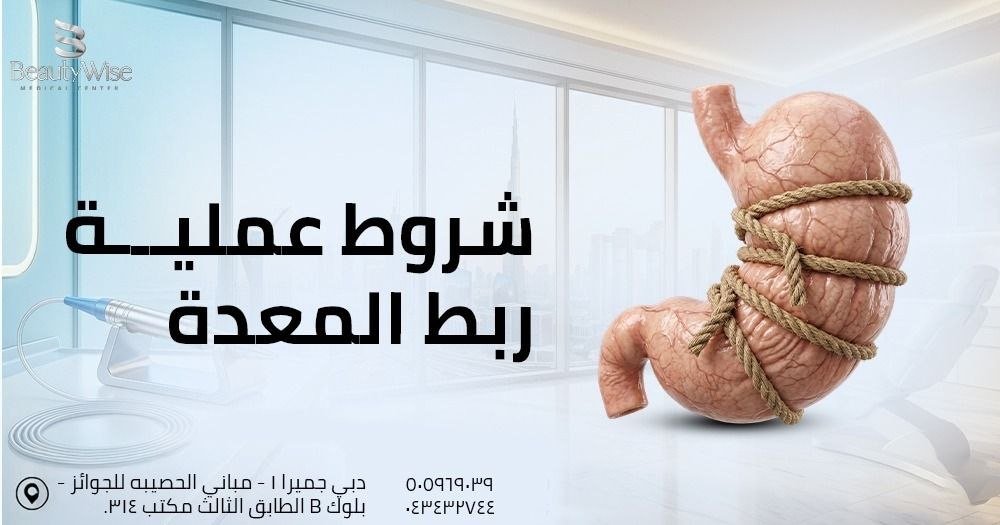 شروط عملية ربط المعدة