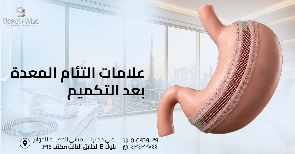 علامات التئام المعدة بعد التكميم