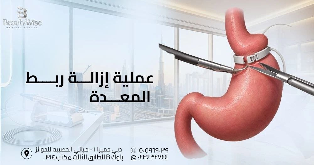 عملية إزالة ربط المعدة