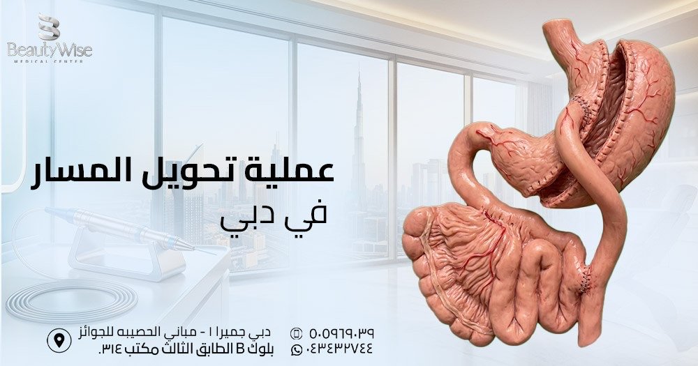 عملية تحويل المسار في دبي