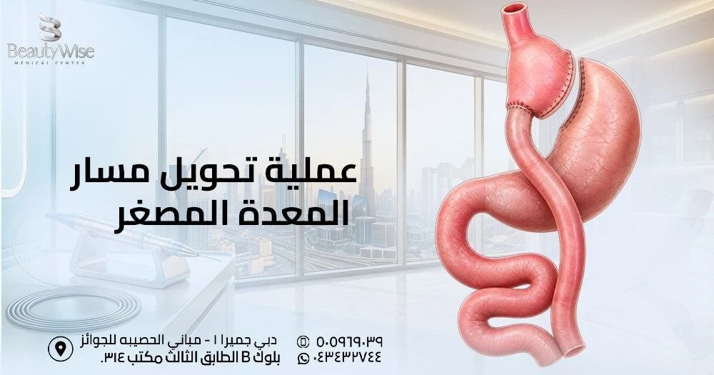 عملية تحويل مسار المعدة المصغر
