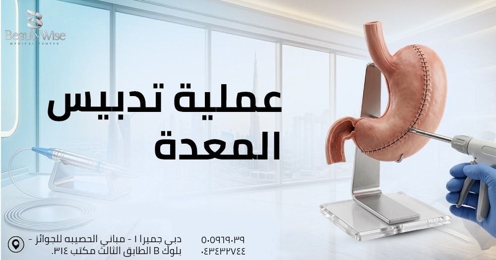 عملية تدبيس المعدة