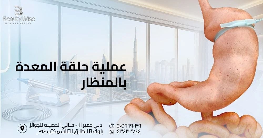 عملية حلقة المعدة بالمنظار