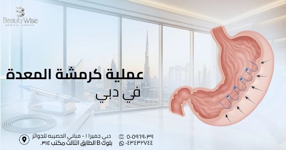 عملية كرمشة المعدة في دبي