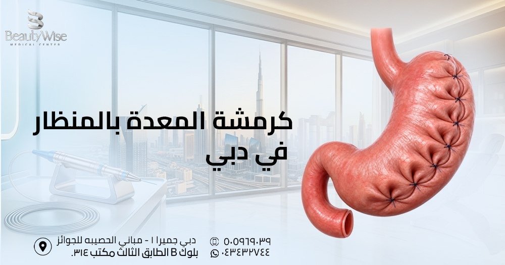 كرمشة المعدة بالمنظار في دبي