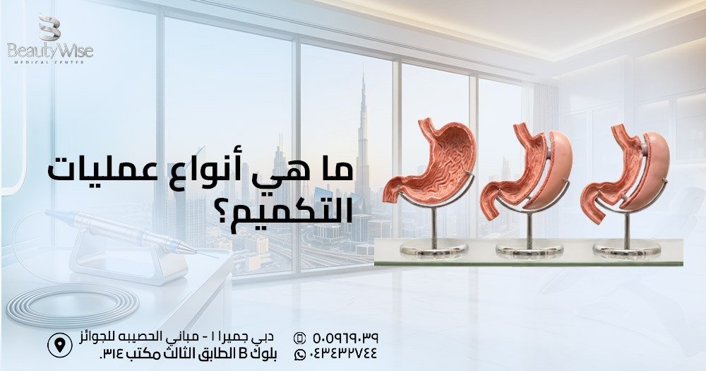 ما هي أنواع عمليات التكميم