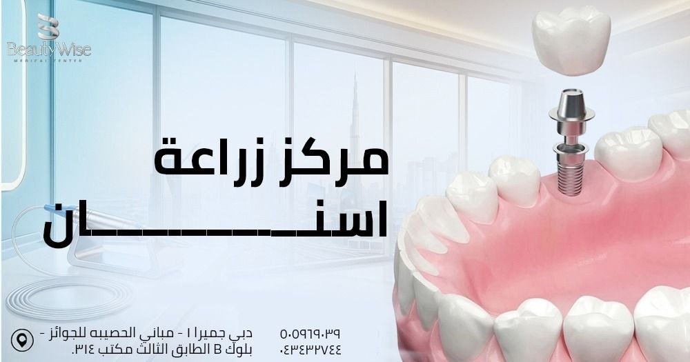 مركز زراعة اسنان