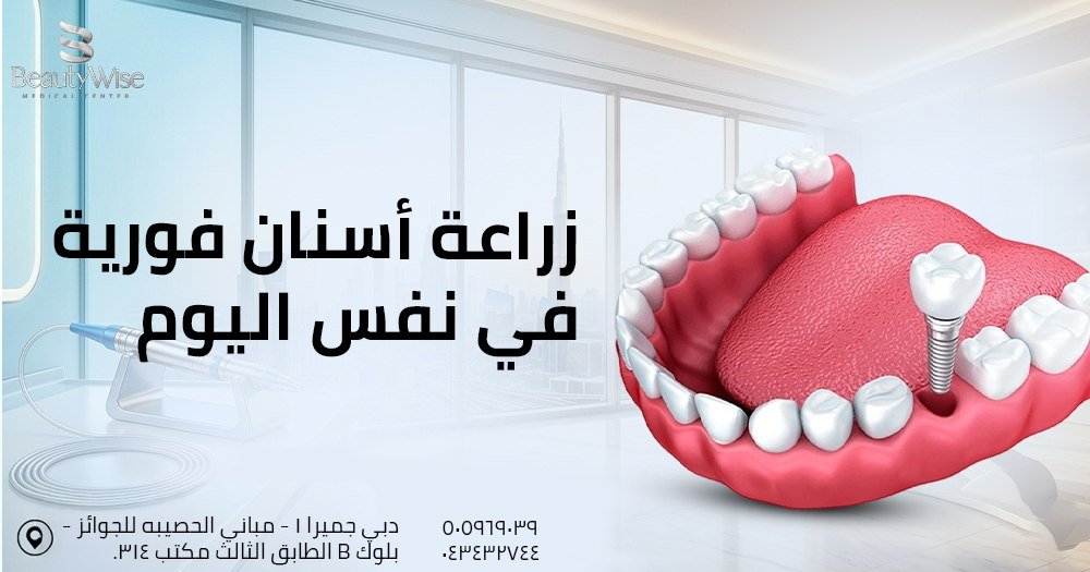 زراعة أسنان فورية في نفس اليوم