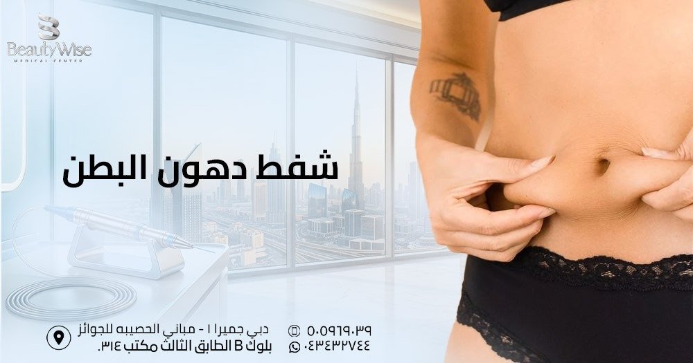 شفط دهون البطن