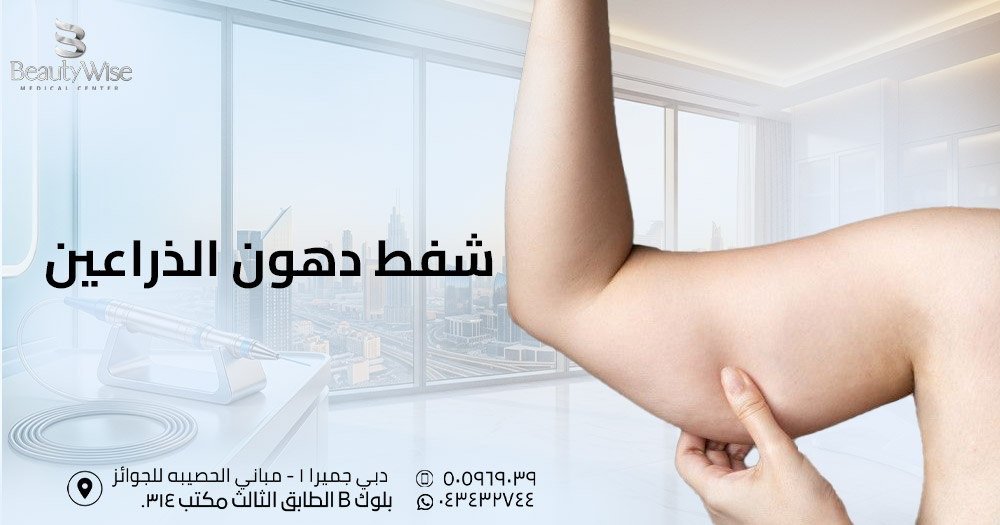 شفط دهون الذراعين