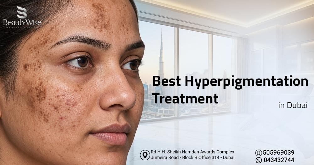 Best Hyperpigmentation Treatment in Dubai