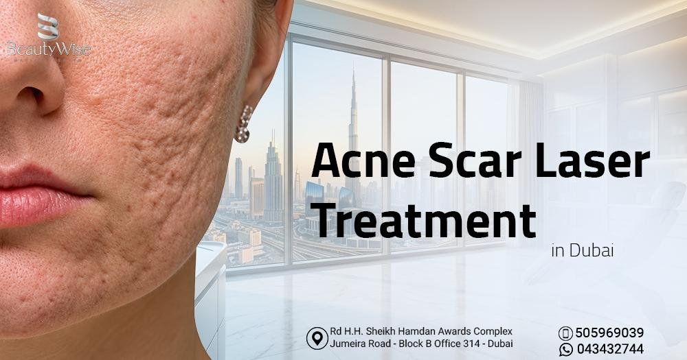Acne Scar Laser Treatment in Dubai