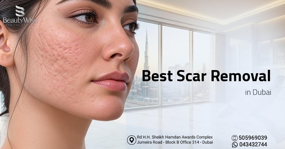 Best Scar Removal Dubai