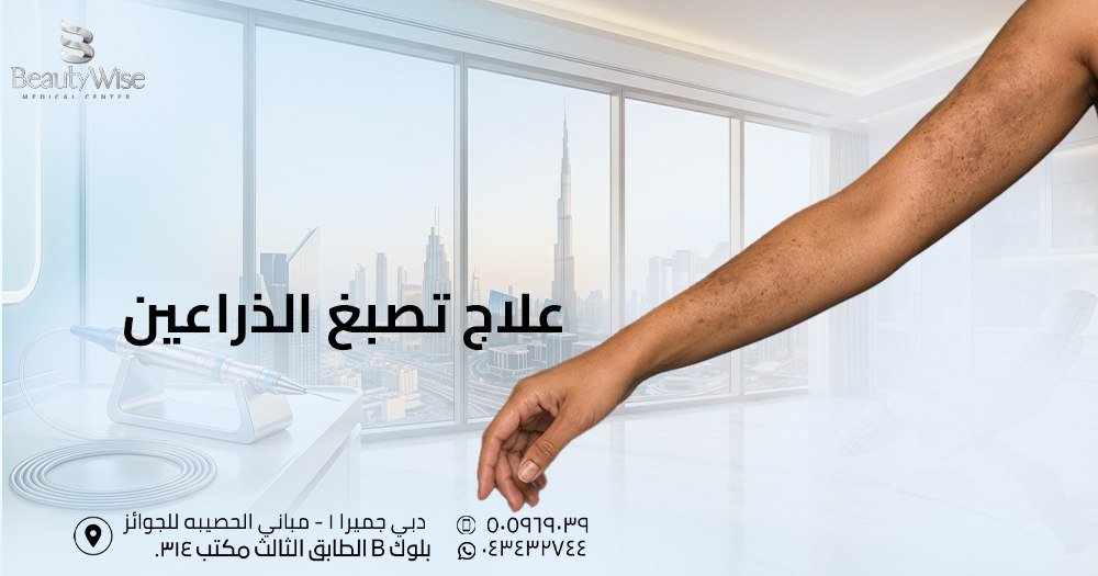 علاج تصبغ الذراعين
