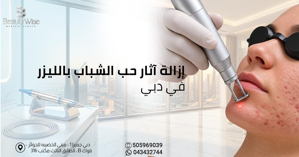 إزالة آثار حب الشباب بالليزر في دبي
