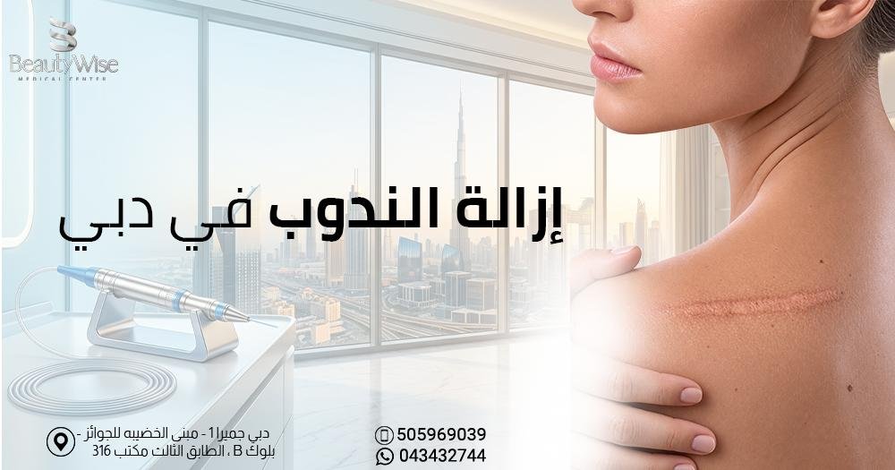 إزالة الندوب في دبي