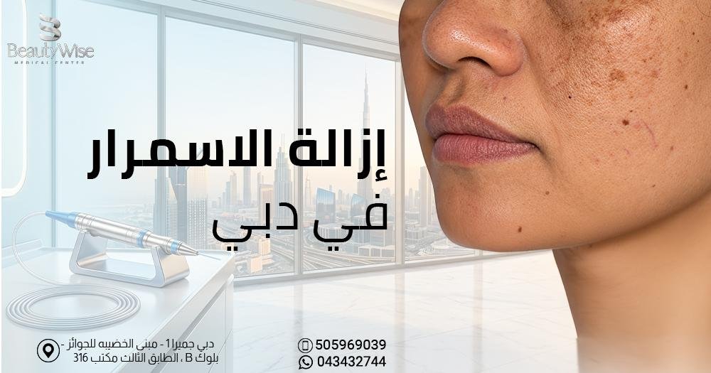 ازالة الاسمرار في دبي