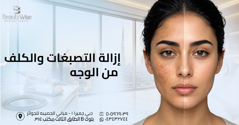 ازالة التصبغات والكلف من الوجه