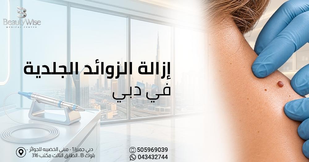 ازالة الزوائد الجلدية في دبي