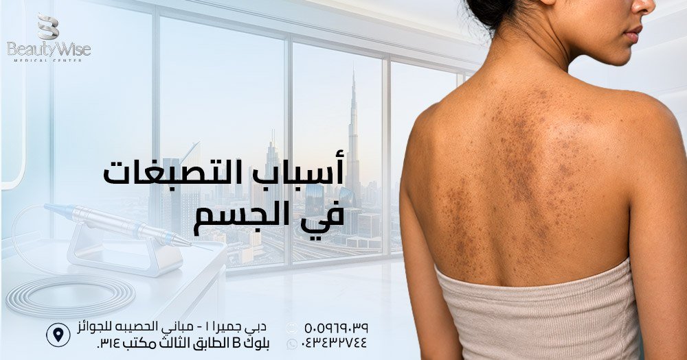 اسباب التصبغات في الجسم