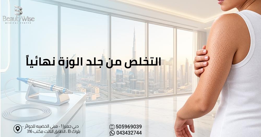 التخلص من جلد الوزة نهائيا