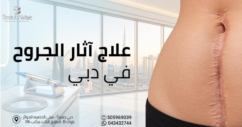 علاج اثار الجروح في دبي