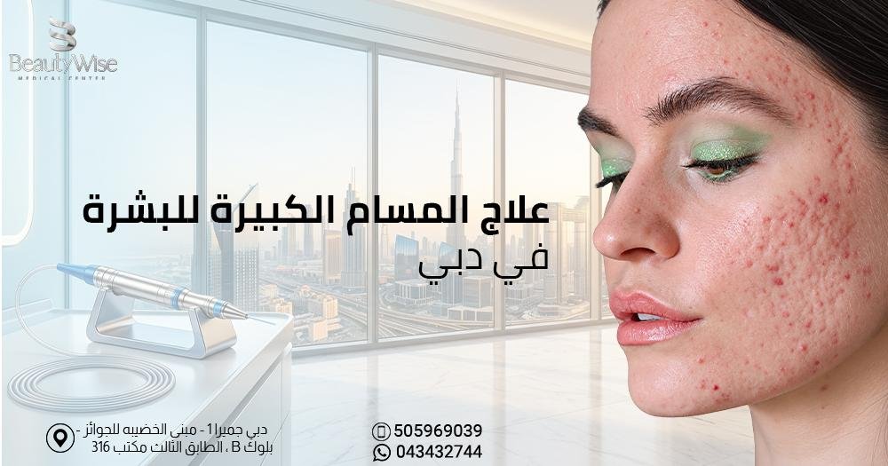علاج المسام الكبيرة للبشرة في دبي