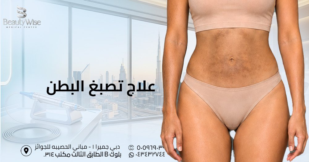 علاج تصبغ البطن