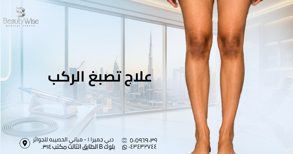 علاج تصبغ الركب