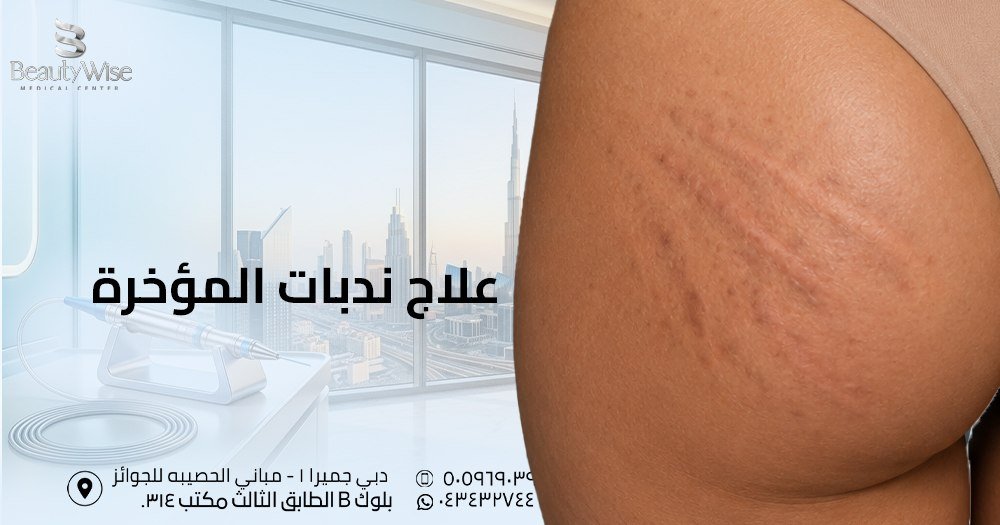علاج ندبات المؤخرة