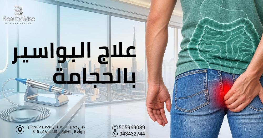 علاج البواسير بالحجامة